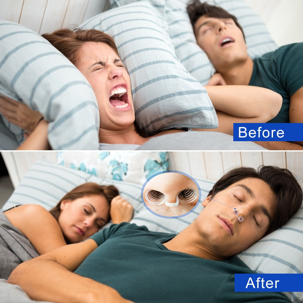 Anti-Snoring Nasal Mouth Piece